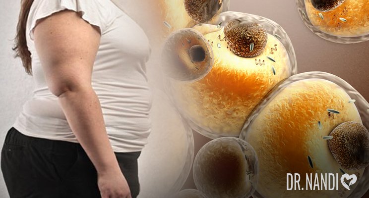 Scientists Say Obesity Can Be Contagious
