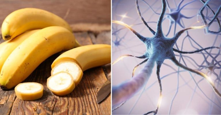 Will A Banana A Day Keep A Stroke Away? Low Potassium Intake May Increase Stroke Risk